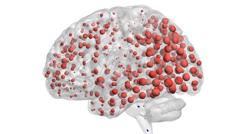 Alzheimer's protein may spread like an infection, human brain scans ...