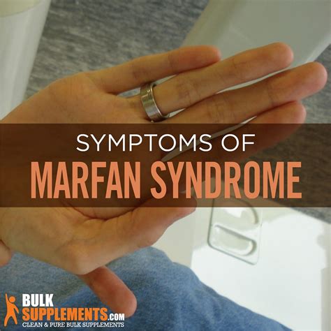 Marfan Syndrome: Causes, Symptoms & Treatment | by James Denlinger | Medium