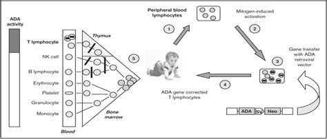 Gene therapy for adenosine deaminase deficiency : Current Opinion in Allergy and Clinical Immunology