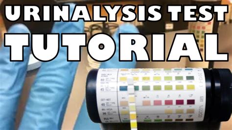 Urinalysis Test