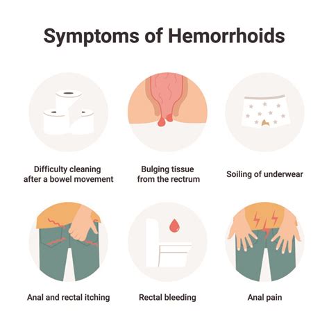 Piles (Haemorrhoids) - Causes, Symptoms, Risk Factors & Treatment | CK Birla Hospital