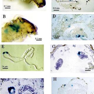 LacZ gene expression in a soft organ after gene bombardment with our... | Download Scientific ...