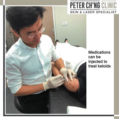 Patient Mailbox: I Wish to Remove My BCG Keloid Scar on My Arm | Peter ...