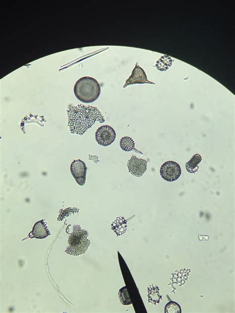 Radiolarians under the microscope. Taken in my Invertebrate Zoology class today. ABatts The ...