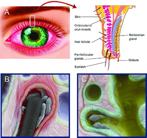 Eyelash schematic and microscopic views of Demodex mites. A Overview... | Download Scientific ...