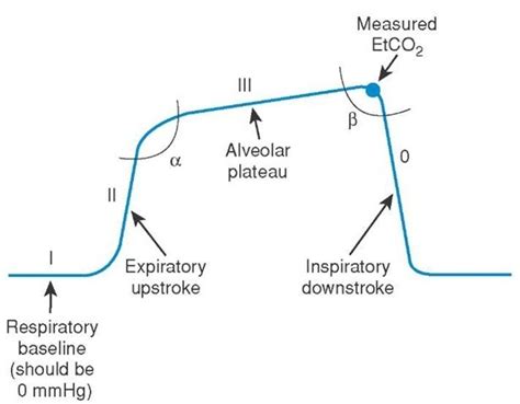 emDOCs.net – Emergency Medicine EducationInterpreting Waveform ...