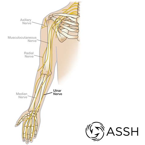 The ulnar nerve is just one of the peripheral nerves in the arm. | Radial nerve, Body anatomy ...