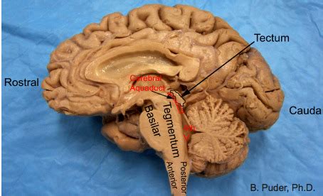 Brain stem part 2 Flashcards | Quizlet