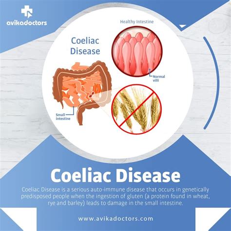 Coeliac Disease | Homeopathy, Homeopathic, Homeopathic medicine