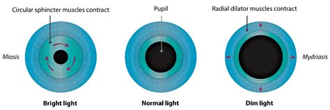 Genes | Free Full-Text | Congenital Microcoria: Clinical Features and Molecular Genetics