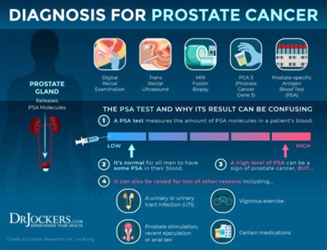 Prostate Cancer: Symptoms, Causes and Support Strategies