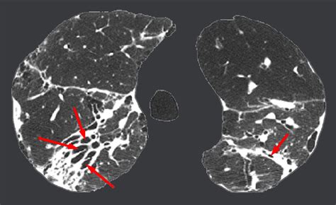 Chest Radiology