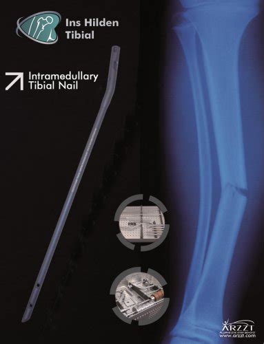 Intramedullary Nail tibia - Truemed Group - PDF Catalogs | Technical Documentation