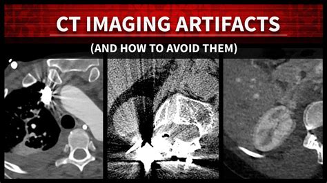 Imaging Artifacts – 3D and Quantitative Imaging Laboratory