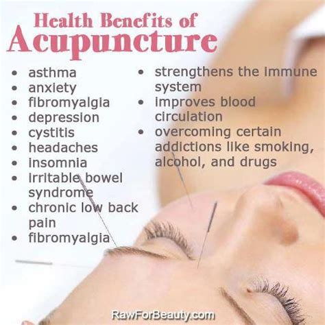 Natural Cures Not Medicine: Health benefits of acupuncture