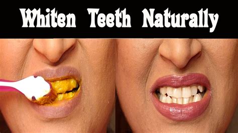 Whiten Teeth Using Turmeric - YouTube