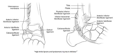 Ankle Syndesmosis Anatomy - Anatomy Reading Source