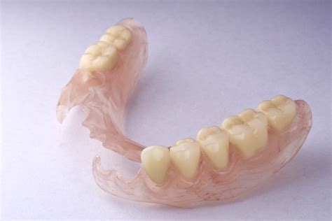 flexible-partial-dentures - South Calgary Denture and Implant Clinic