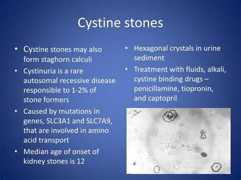 PPT - Staghorn calculi – causes and treatment PowerPoint Presentation - ID:223254