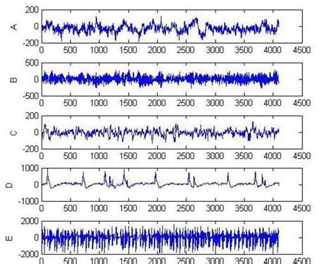 Sample Recordings of EEG Signal A, B, C, D And E Dataset From Top To ...