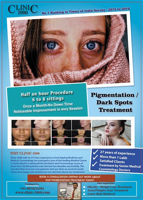 Pigmentation Treatment In Hyderabad Pigmentation Treatment - Clinic 2000