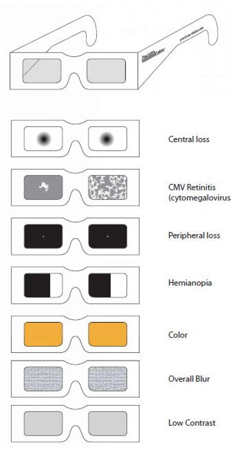 Lighthouse Simulator Glasses Kit - Low Vision Aids - Precision Vision