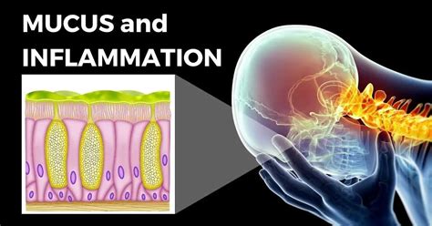 The Relationship Between Mucus And Inflammation And Steps To Eliminate It