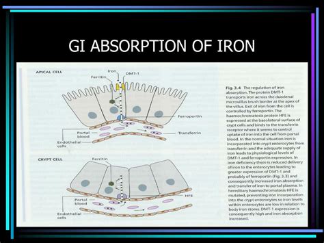 PPT - IRON METABOLISM DISORDERS PowerPoint Presentation, free download - ID:1285171