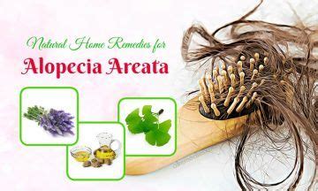 Natural Home Remedies for Alopecia Areata