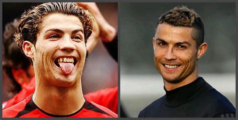 Cristiano Ronaldo Teeth Before