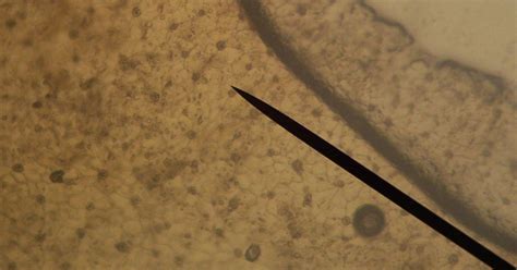 Pharmacy Student: paracytic stomata