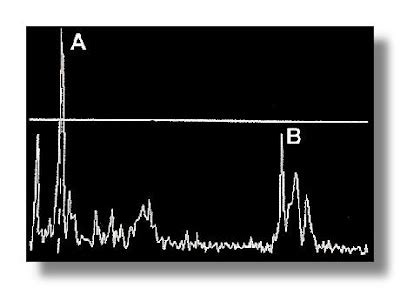 A Medical Student's Guide To: Ultrasound Imaging Modes