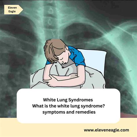 White Lung Syndromes: What Is The White Lung Syndrome? Symptoms And ...