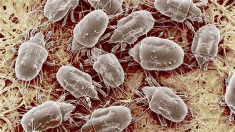 How To Get Rid Of Dust Mites: 10 Things You need to Know