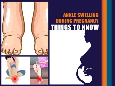 Ankle Swelling During Pregnancy - Fernandez Hospital