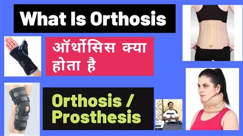 Orthosis-what is Orthosis|Difference between orthosis & prosthesis ...