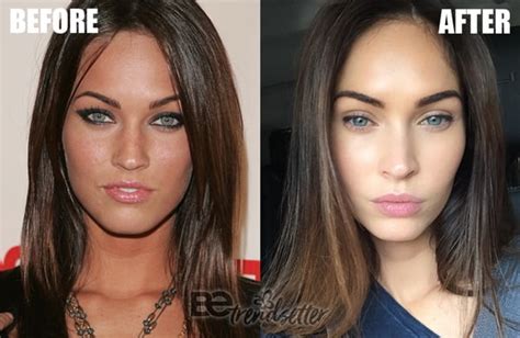 Megan Fox Plastic Surgery Before And After REVEALED!