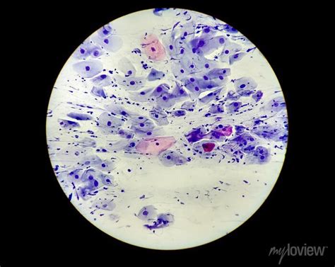 Conventional pap smear microscopic image of endocervical cells posters for the wall • posters ...