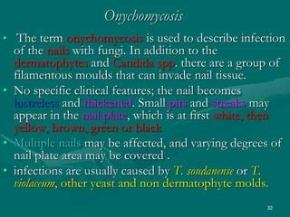 dermatophytes infections | PPT