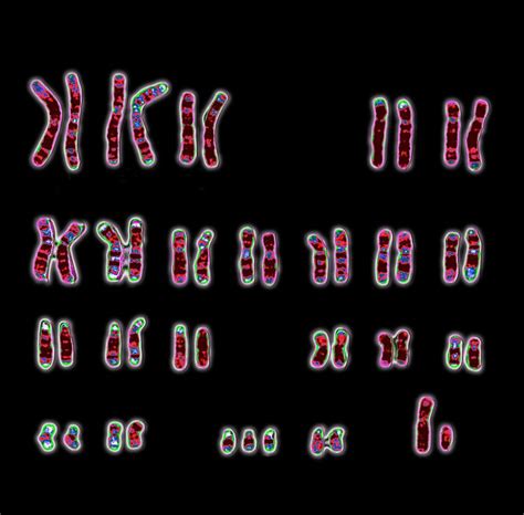 Karyotype | Description, Chromosome Aberration, & Uses | Britannica