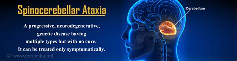 Spinocerebellar Ataxia - Types, Causes, Symptoms, Diagnosis, Treatment & Prevention