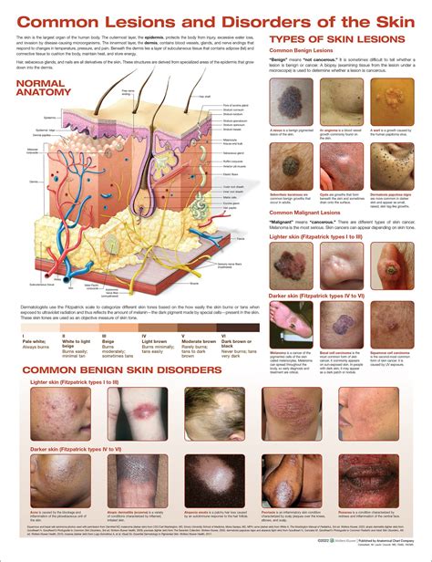 Common Lesions and Disorders of the Skin Anatomical Chart: Anatomical ...