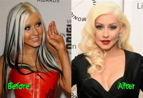 A Take on Christina Aguilera Plastic Surgery