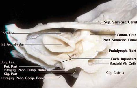 The Internal Acoustic Meatus, Semicircular Canals, and Cochlea | Neuroanatomy | The ...