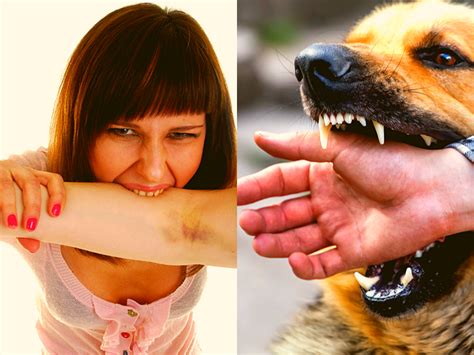 Should You Get A Tetanus Shot After A Dog Bite