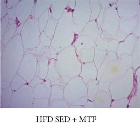 Gastrocnemii’s epimysium histology of HFD-treated groups.... | Download ...