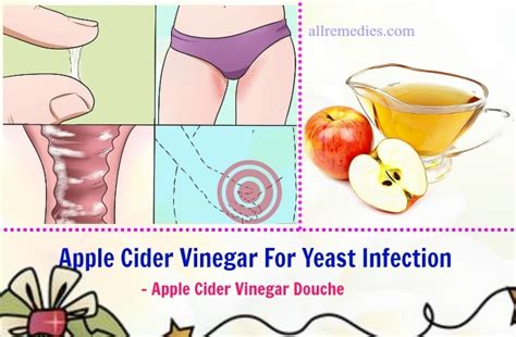 12 Tips Using Apple Cider Vinegar For Yeast Infection Treatment