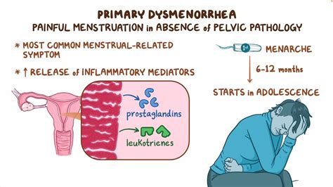 Primary dysmenorrhea: Clinical sciences - Osmosis Video Library