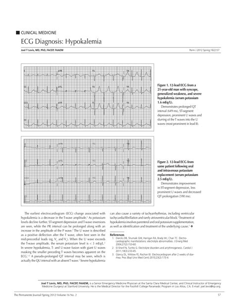 What Electrolyte Causes U Wave - cloudshareinfo