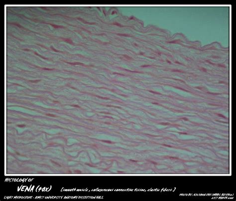 Histology: Blood Vessels - My Aimst University Lifestyle Blog